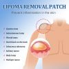 South Moon Lipoma Removal Patch, Various Fat Knots To Subcutaneous Lumps Care Patch